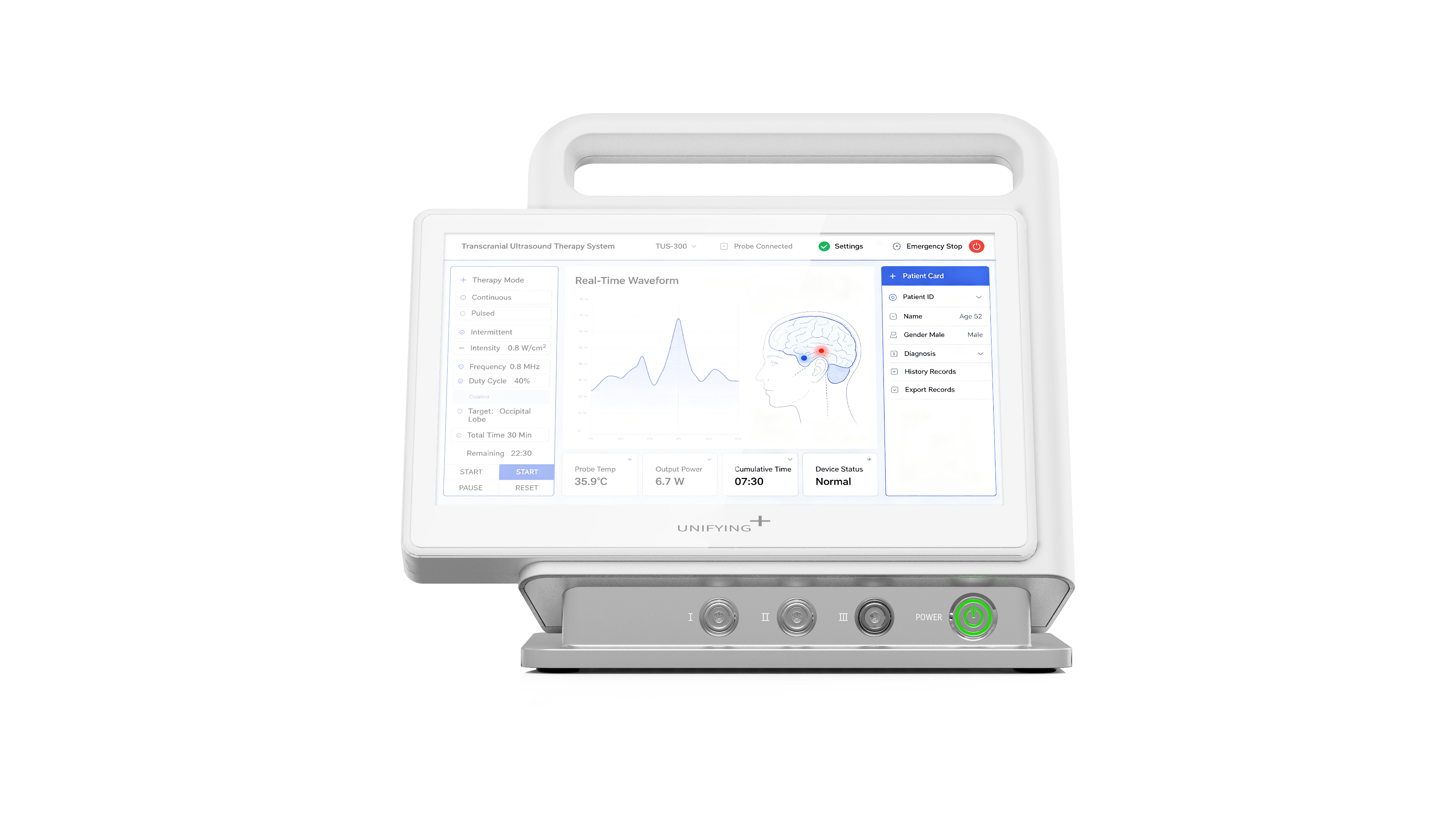 Chengdu Industrial Design, Chengdu Medical Design, Ultrasonic Equipment Design，