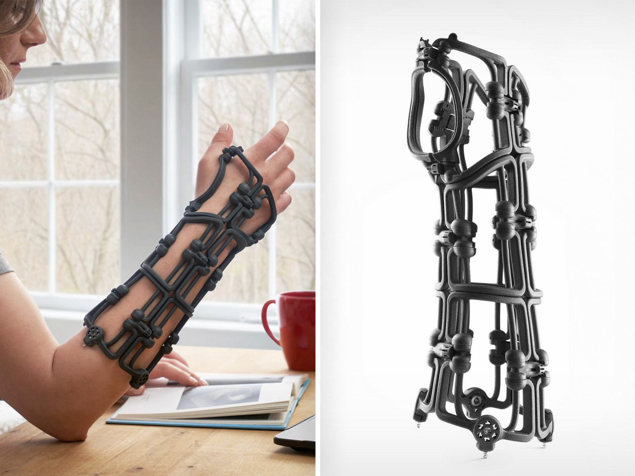 Bracesys，Kevlar medical brace，Fixator，PCA Size Normalization，recyclable reuse，