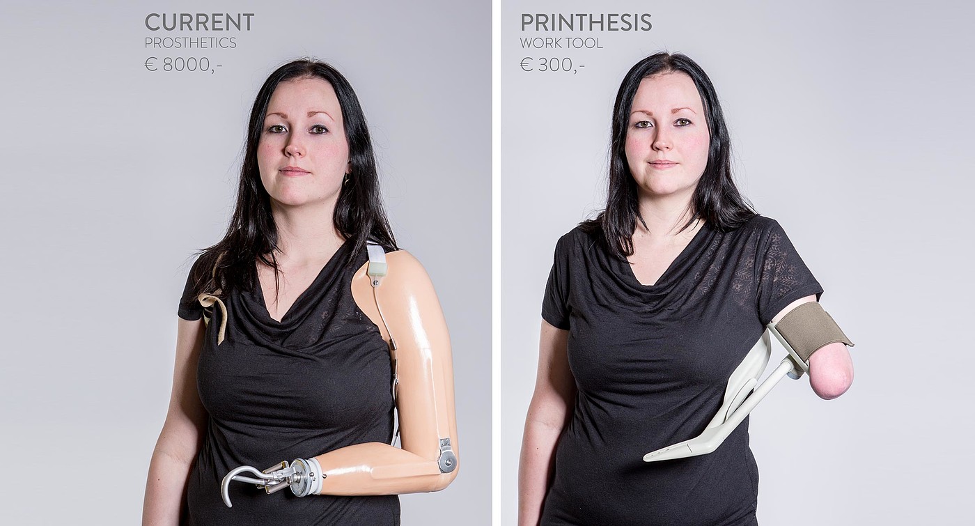 Prosthesis，3D printing，medical apparatus and instruments，