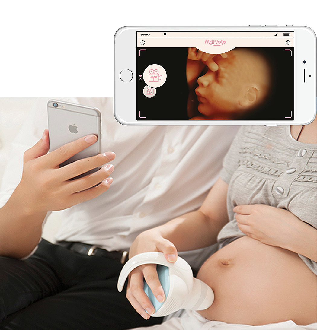 Fetal imaging，Handheld，ultrasonic，Marvoto，maximal，