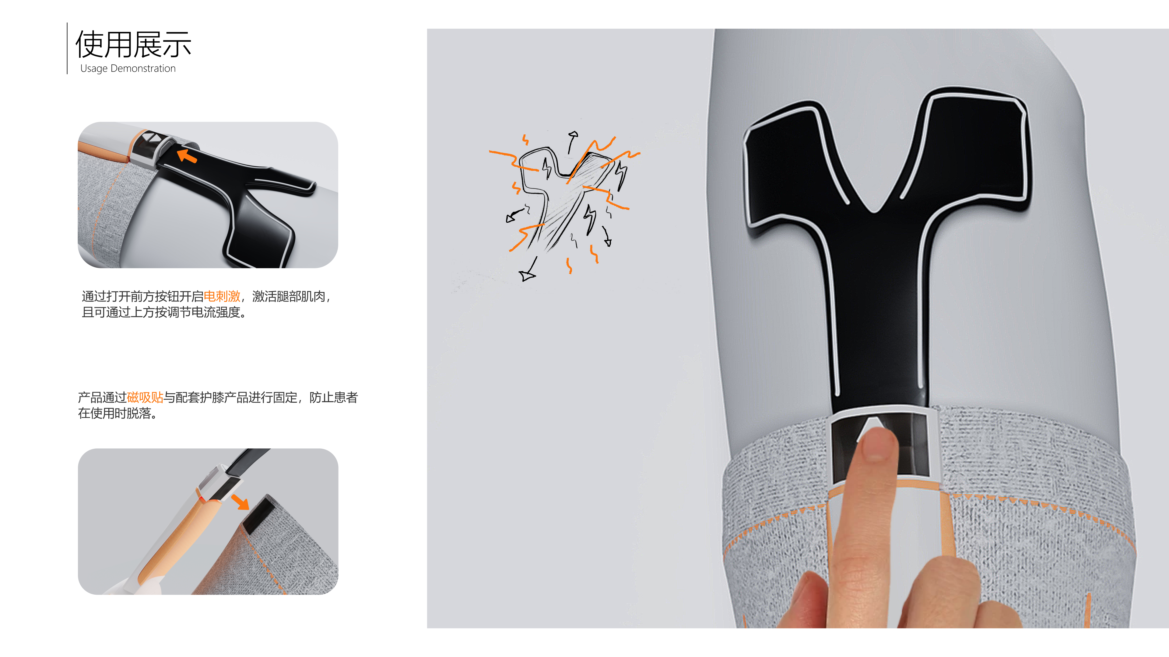 kneepad，Rehabilitation brace，Concept product，Anterior cruciate ligament post surgery，industrial design，product，