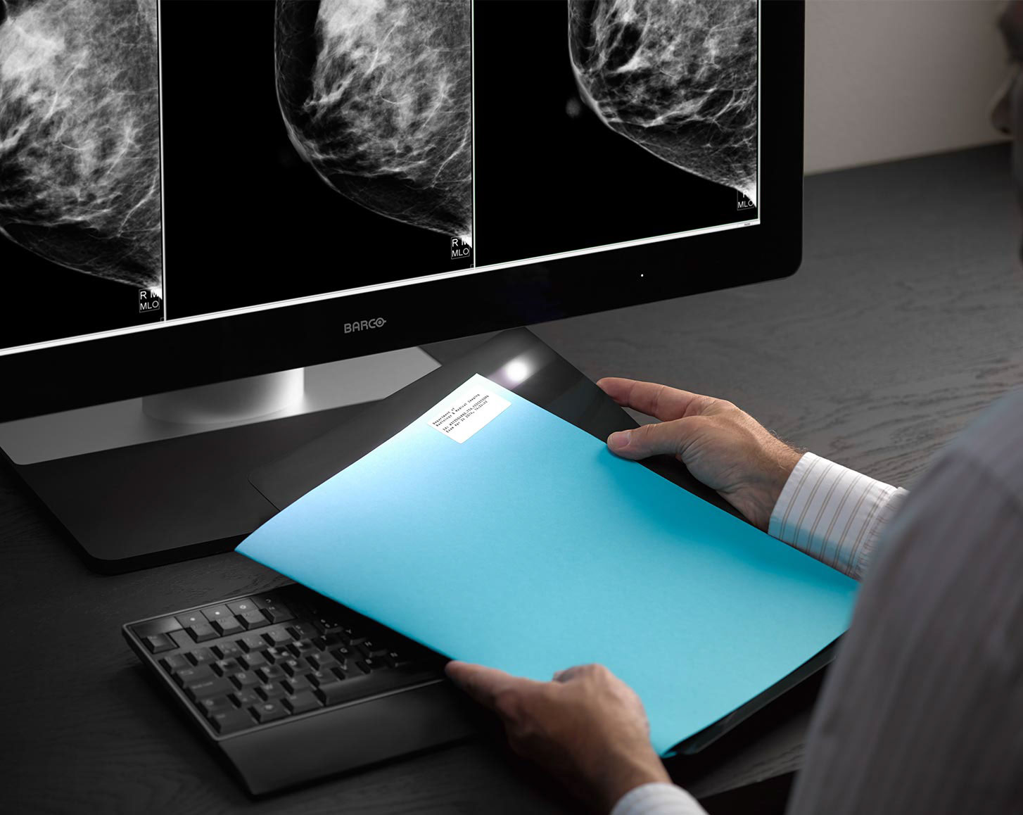 product design，medical apparatus and instruments，Intelligent display，