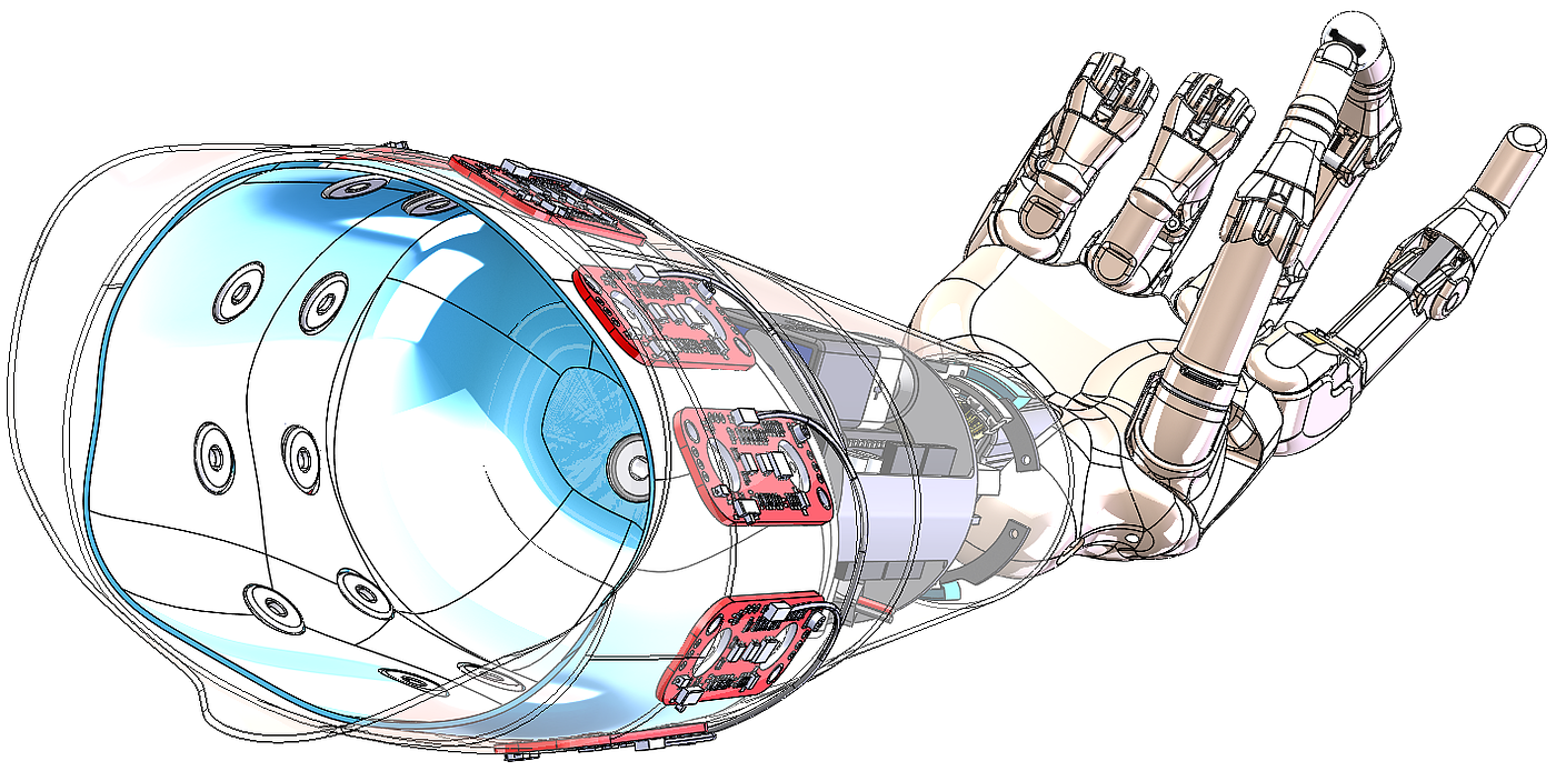 Prosthesis，