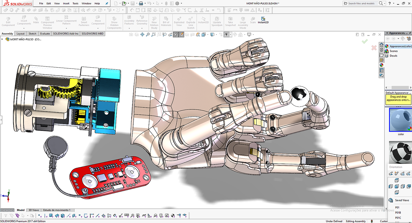 Prosthesis，