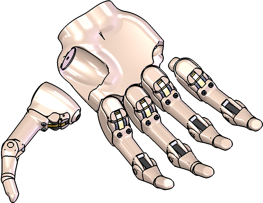 Prosthesis，