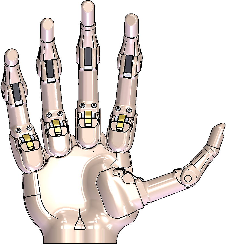 Prosthesis，