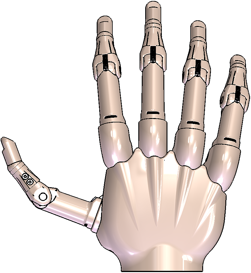 Prosthesis，