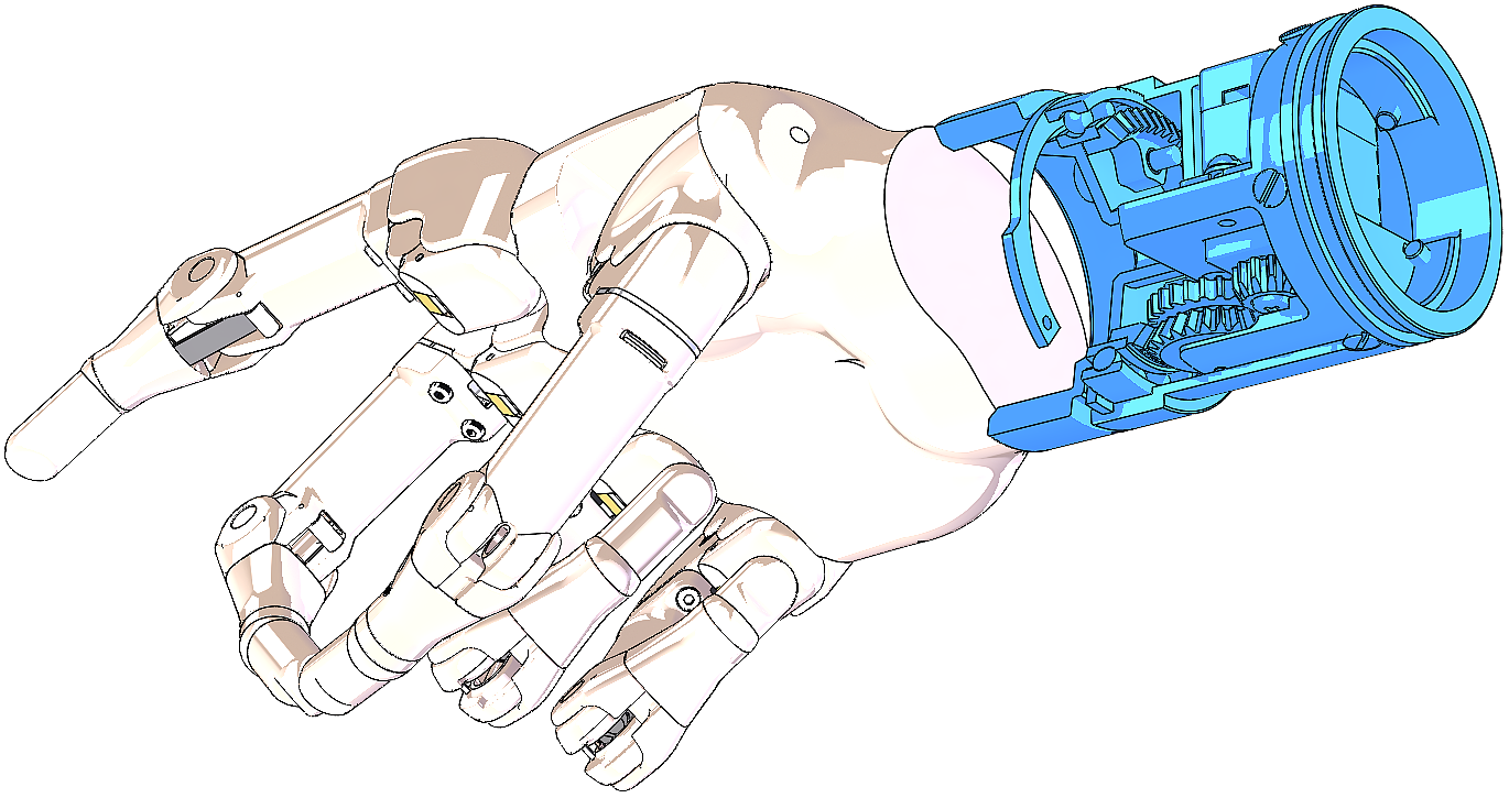 Prosthesis，
