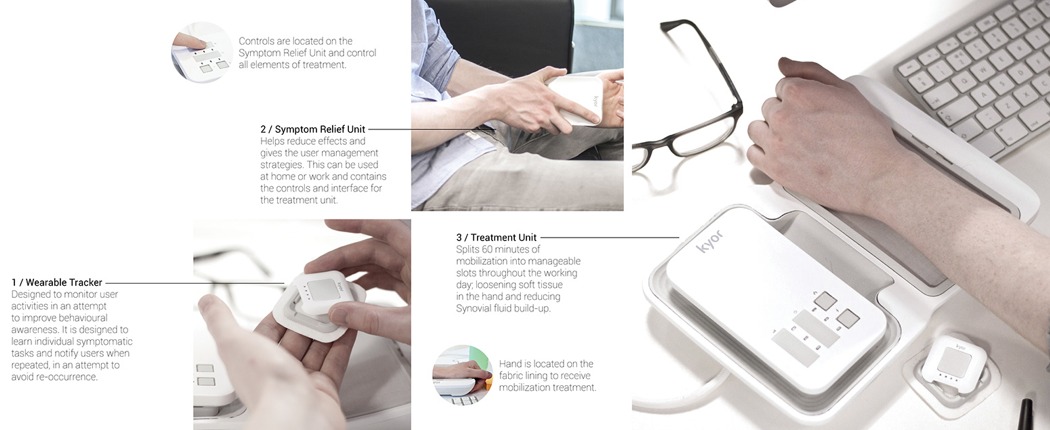 Medical products，Carpal tunnel syndrome，Intelligent products，Health monitoring，Numbness of fingers may be a symptom，Chris Thursfie，