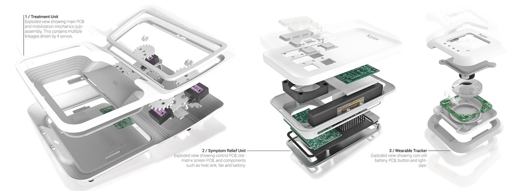 Medical products，Carpal tunnel syndrome，Intelligent products，Health monitoring，Numbness of fingers may be a symptom，Chris Thursfie，