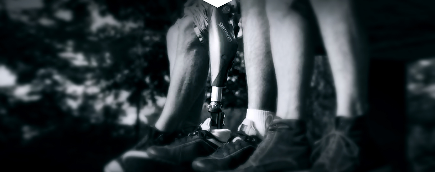 2015if Award，2015 red dot award，Legs，medical care，intelligence，Prosthesis，