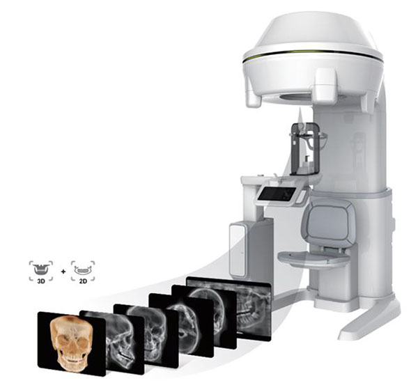 X-ray fluoroscopy equipment，industrial design，product design，Medical equipment，Portable，New equipment，