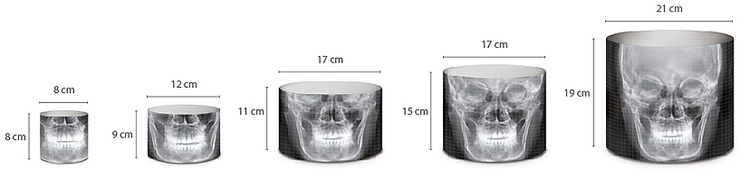 X-ray fluoroscopy equipment，industrial design，product design，Medical equipment，Portable，New equipment，