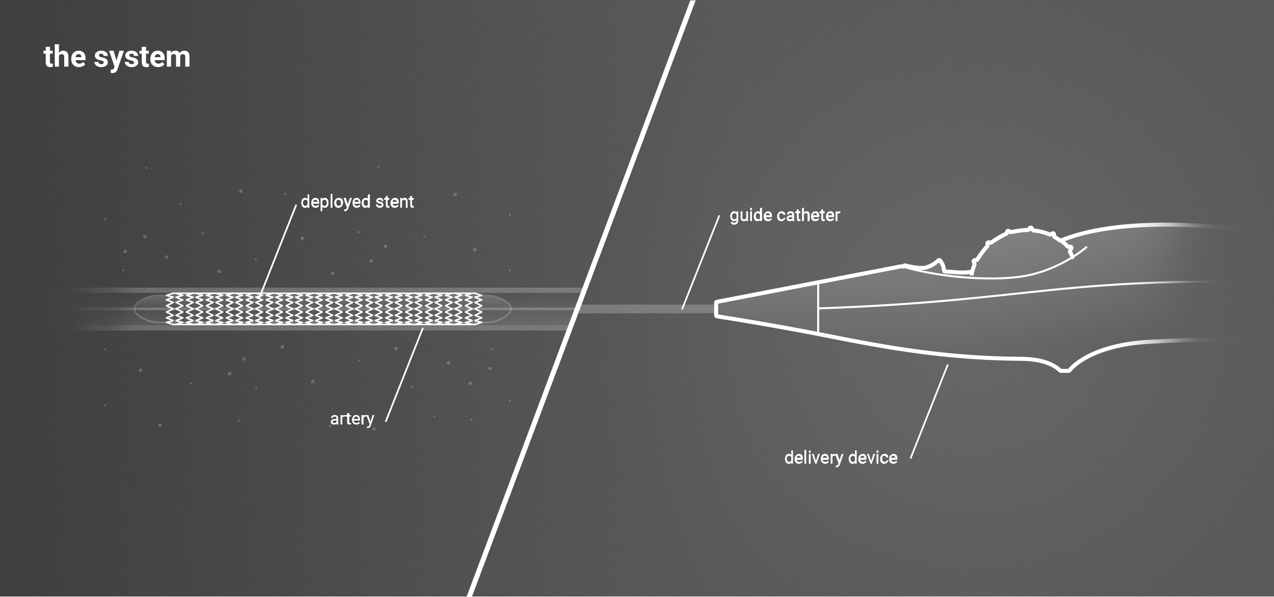 Bard，Support conveyor，product design，