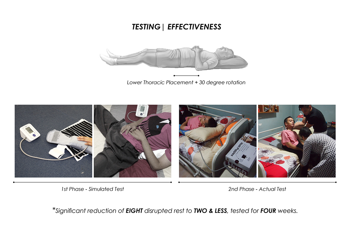 Bed rotation，innovate，Medical design，User experience，