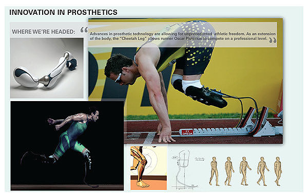 industrial design，product design，medical care，prosthesis ，