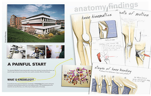 industrial design，product design，medical care，prosthesis ，