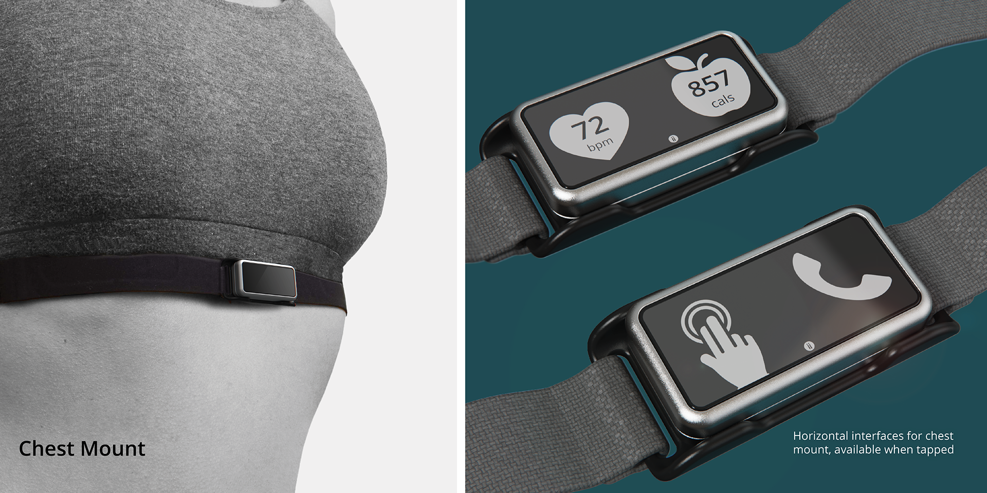 Annex，Wearable system，intelligence，Medical equipment，