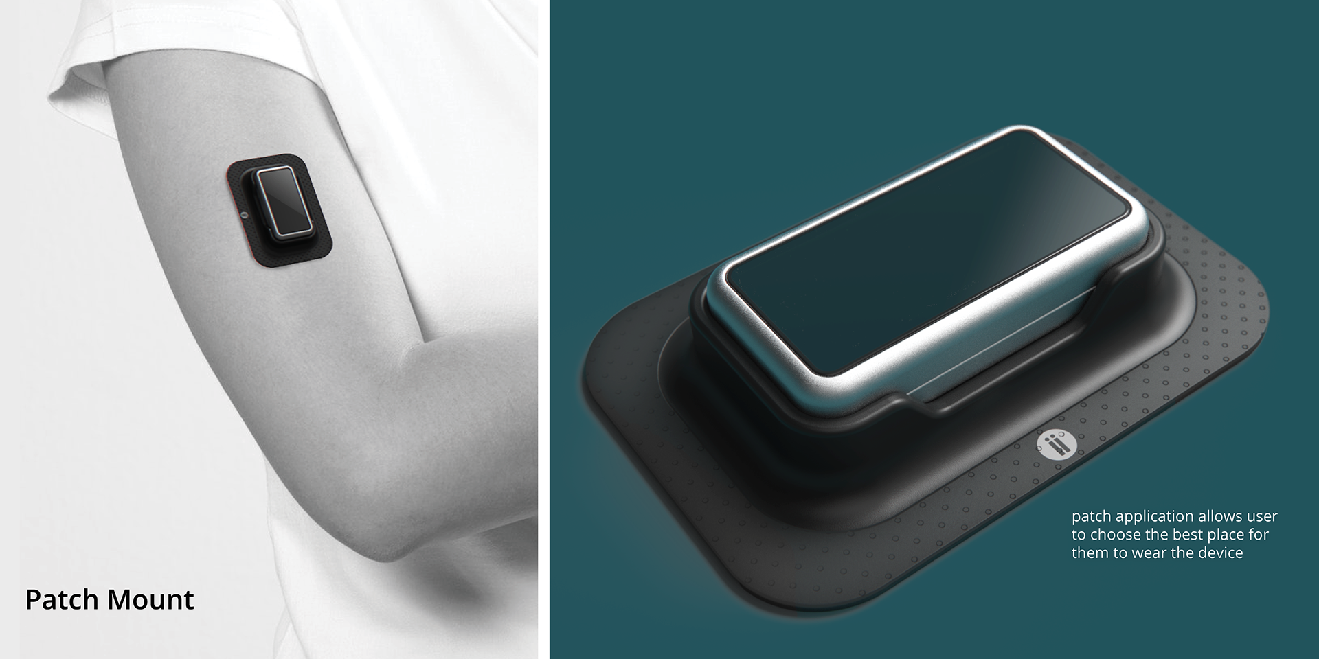 Annex，Wearable system，intelligence，Medical equipment，