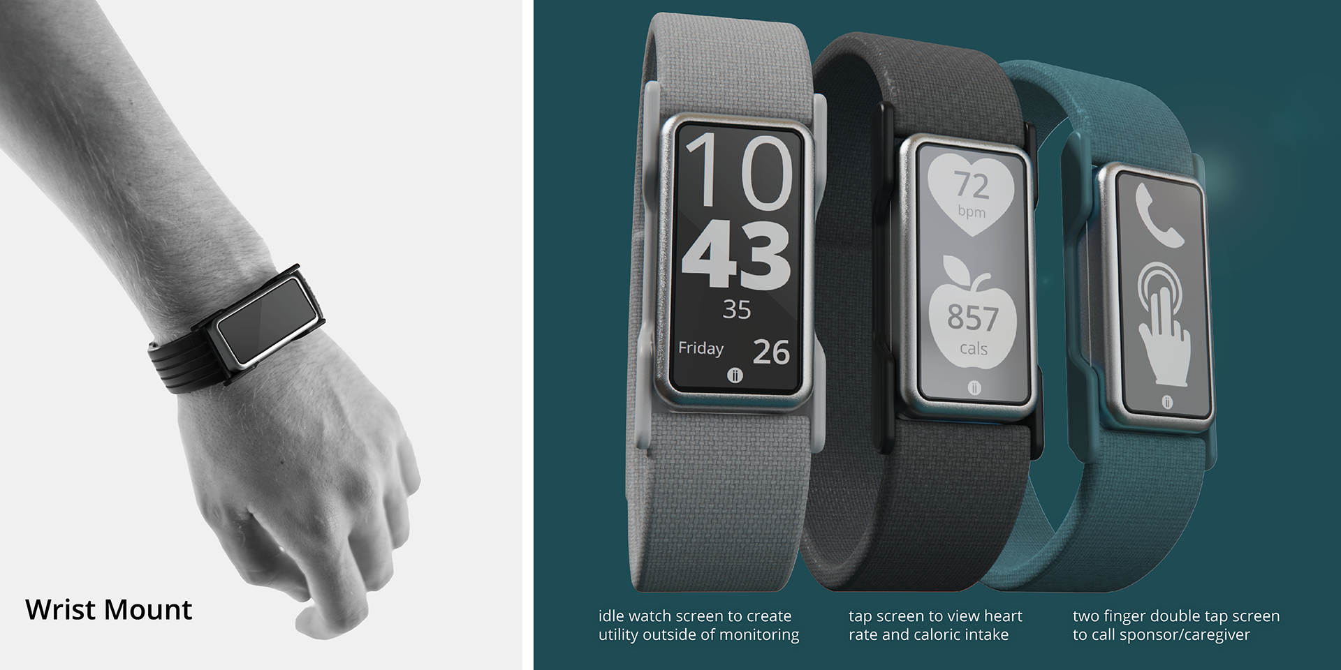 Annex，Wearable system，intelligence，Medical equipment，