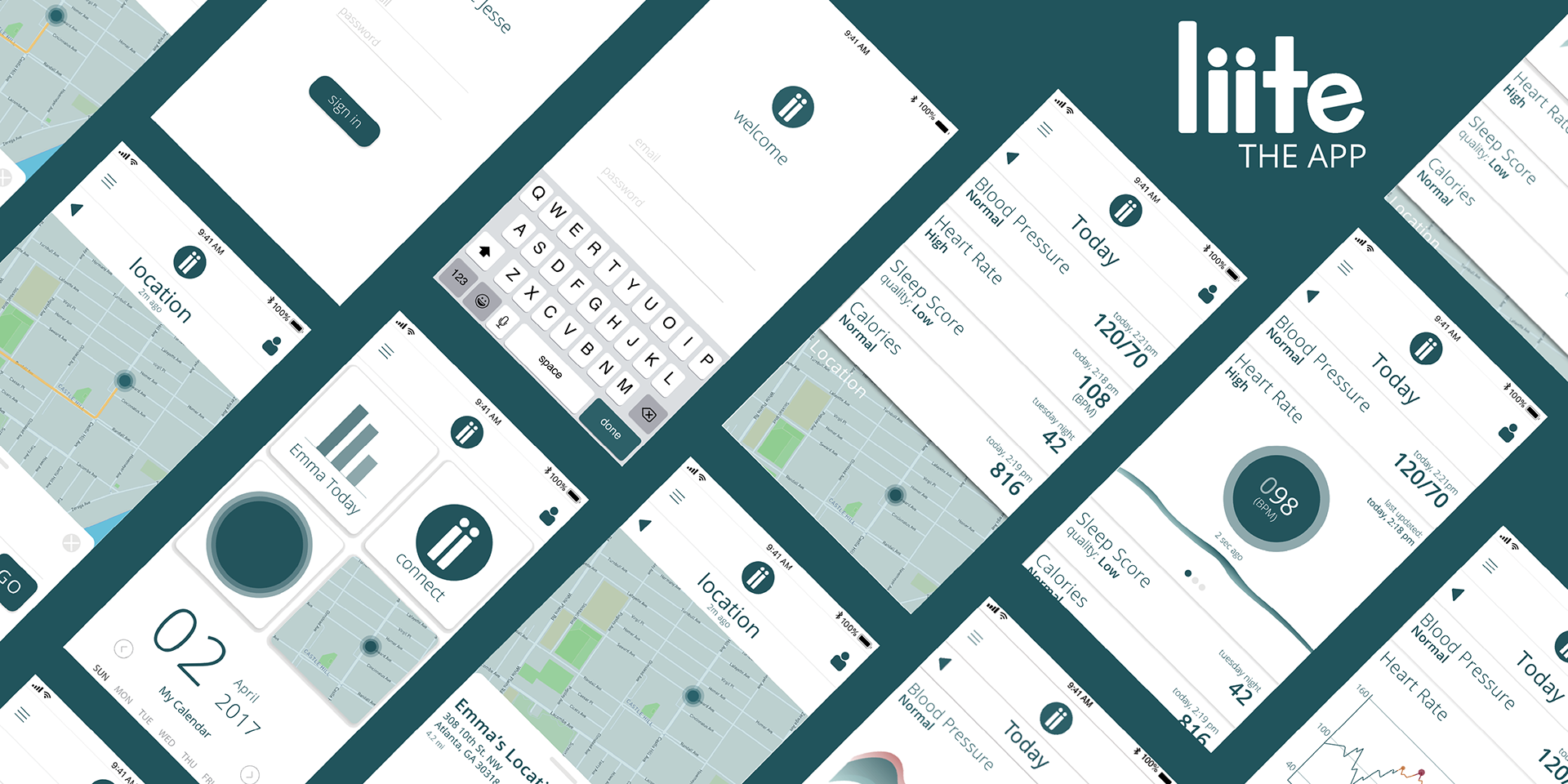 Annex，Wearable system，intelligence，Medical equipment，