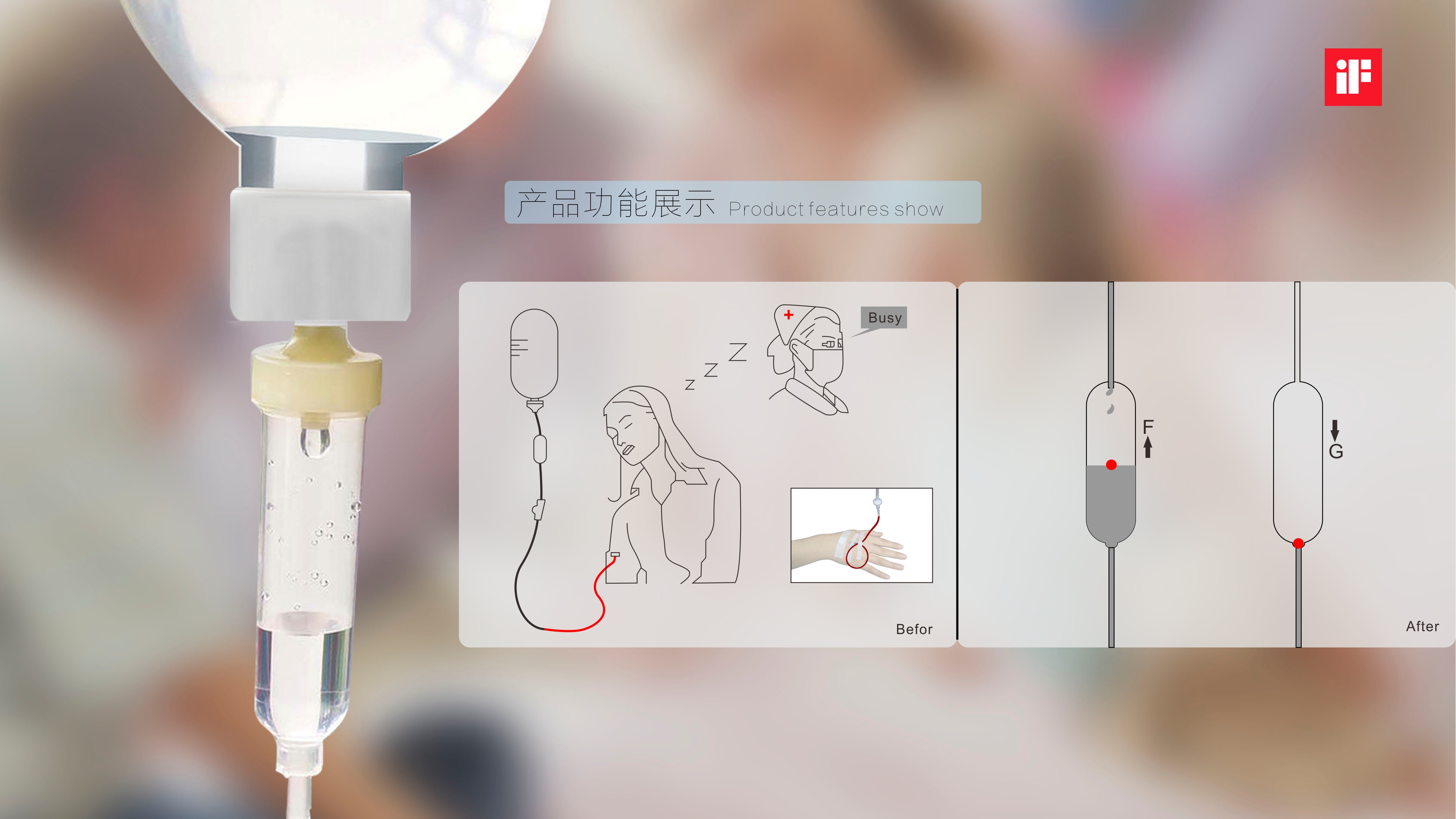 Design of a safe infusion set for preventing blood return，