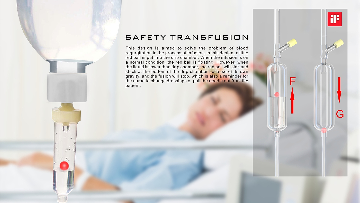 Design of a safe infusion set for preventing blood return，