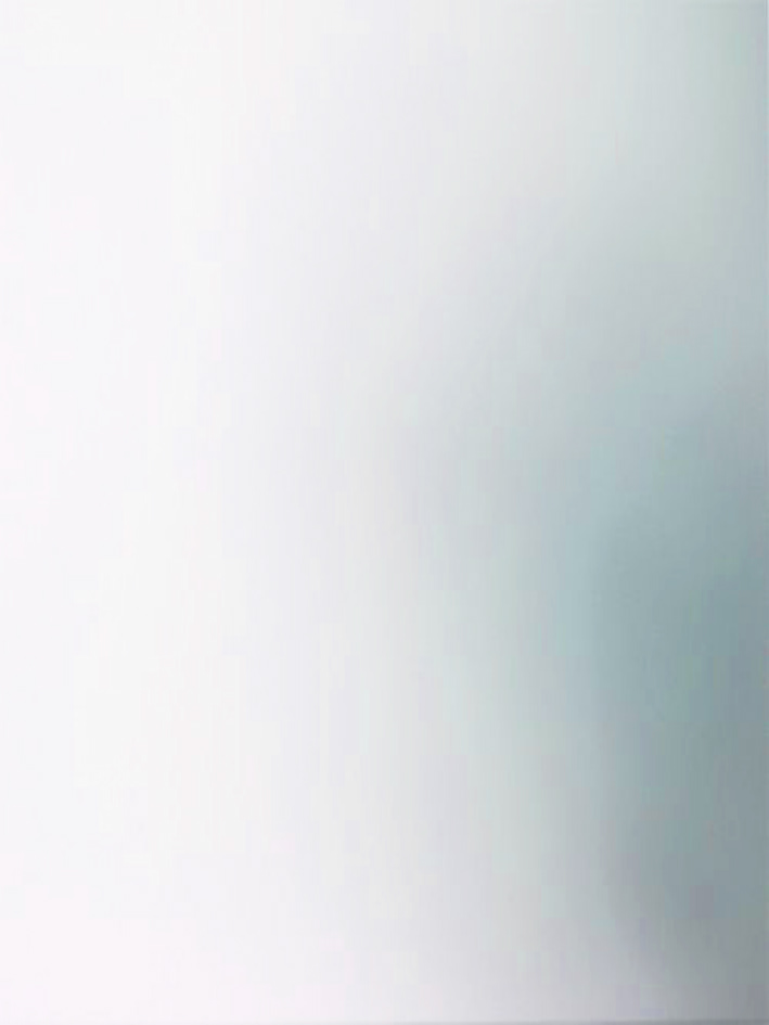 Native Beauty，Restoring the essence of the ampoule，Ampoule Set，Second White，Maintenance products，Cosmetics，Medical beauty，Medicated makeup，