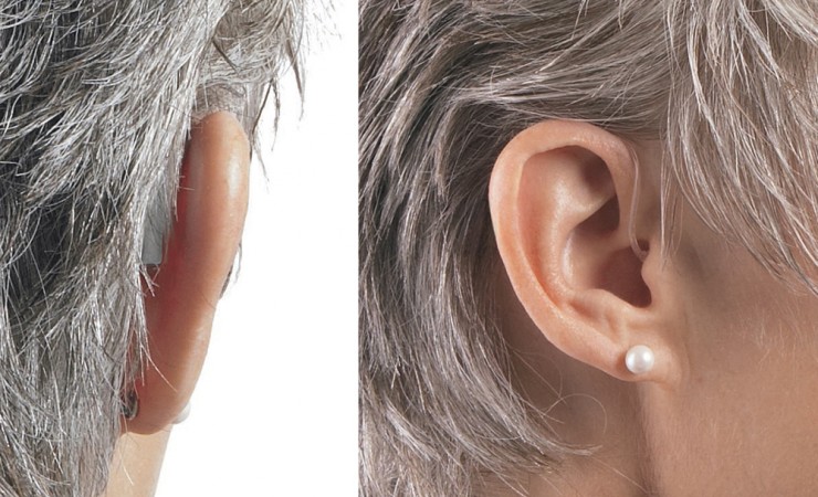 deaf-aid，medical care，