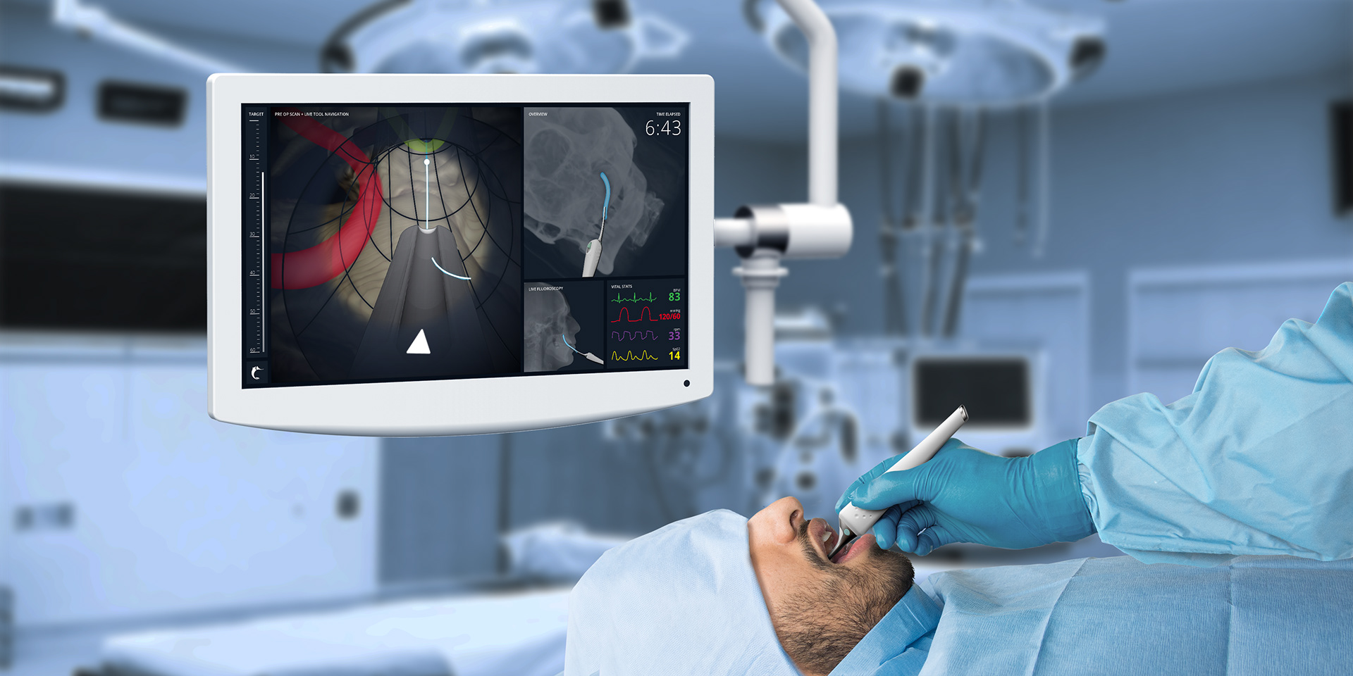 nerve，injection，Chimaera，