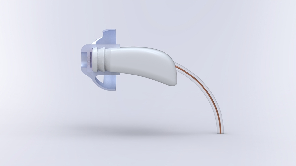 intiga，deaf-aid，Wireless hearing aid，The best in the world，