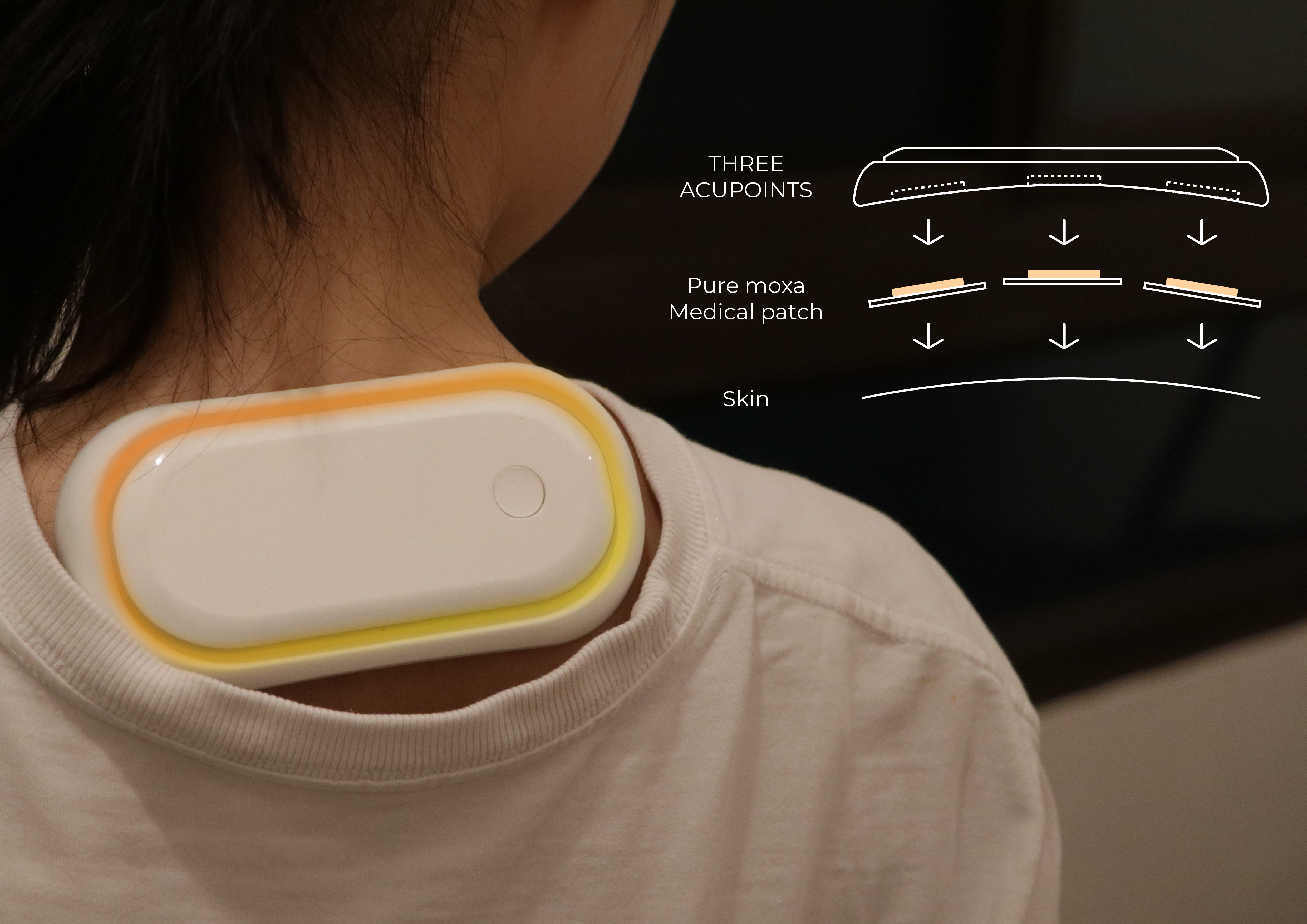 Graduation project，Design，Intelligent device，health preservation，Home medical，moxibustion，