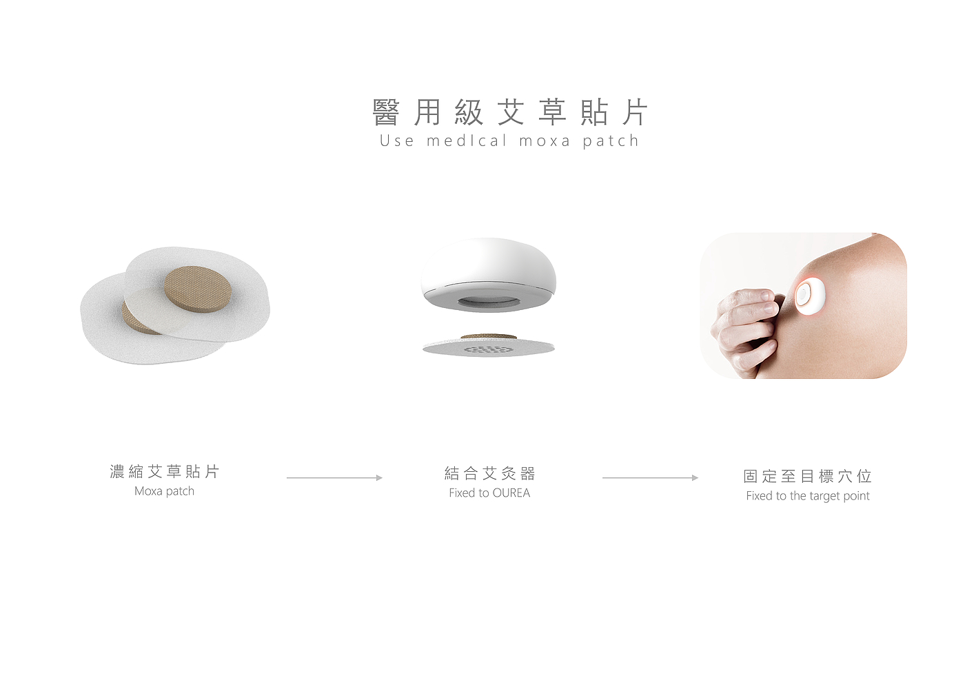 Graduation project，Design，Intelligent device，health preservation，Home medical，moxibustion，