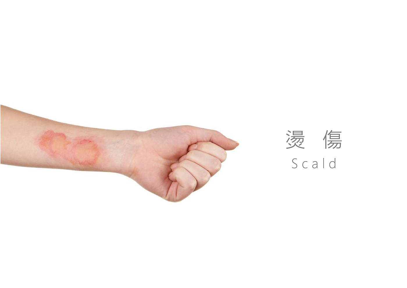 Graduation project，Design，Intelligent device，health preservation，Home medical，moxibustion，