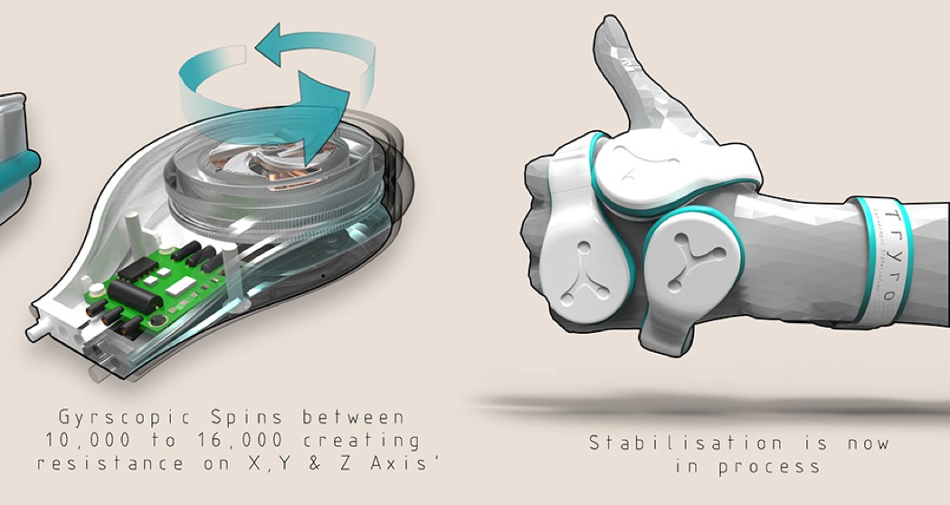 Tryro，Wearable ，Hand spasm，