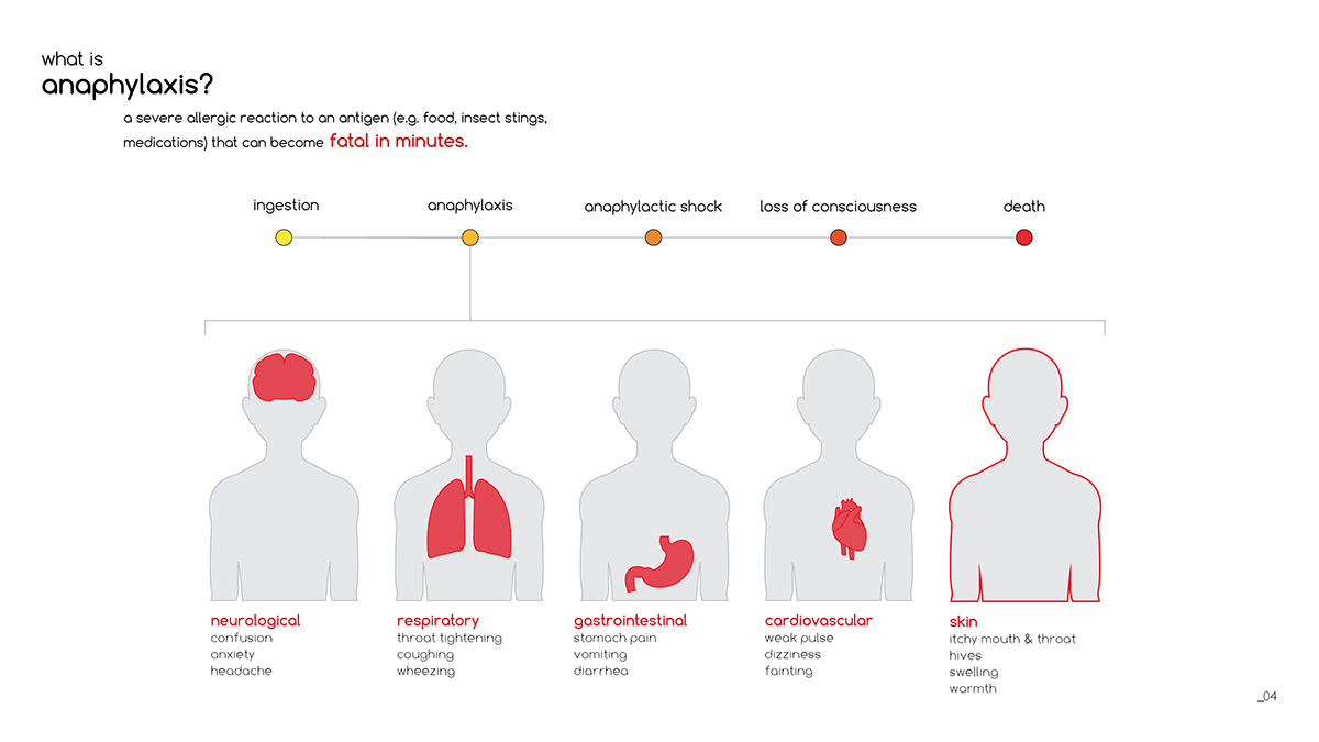 Abby，Detector，intelligence，